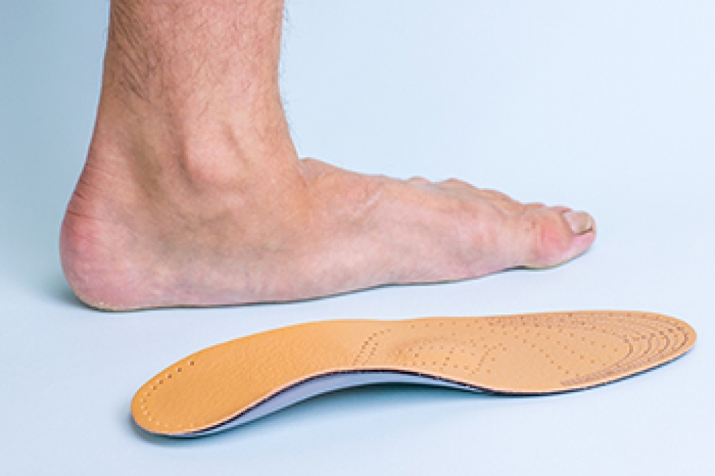 Comparing Arch Support and Insoles for Flat Feet Relief