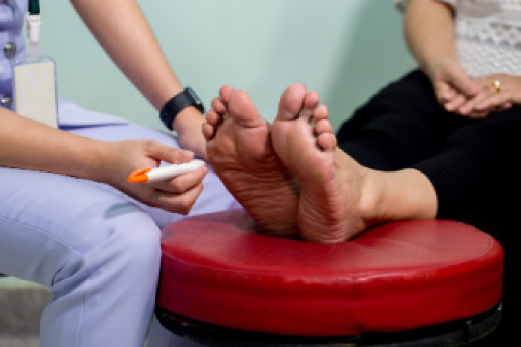 Signs and Risk Factors of Smoker’s Feet