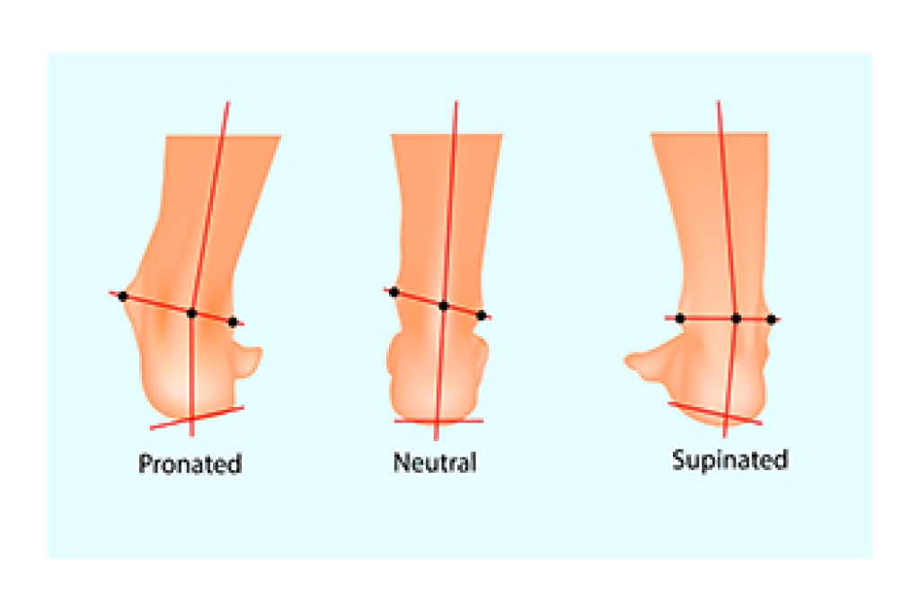 Understanding Pronation and Supination in the Feet