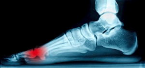 What Are the Sesamoids?