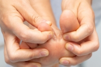 Why Does Athlete’s Foot Recur?